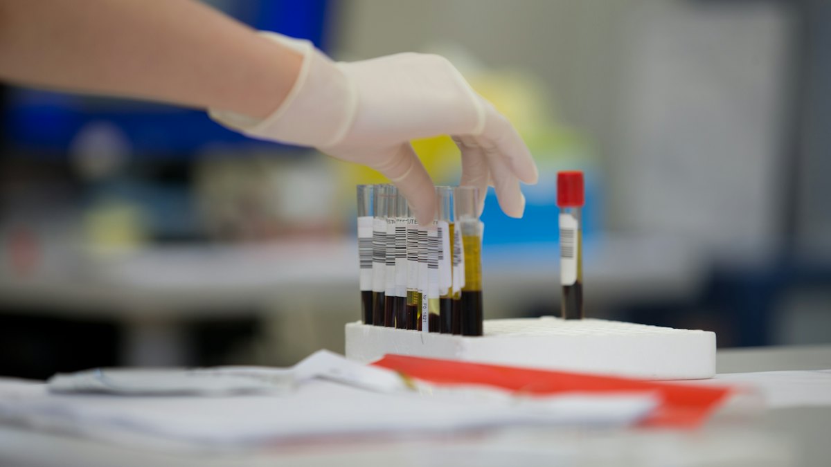 Blood sample tubes in the lab